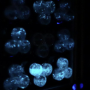 A microscopic image of blue algae cells against a black backdrop. They glow with a blue luminescence. 